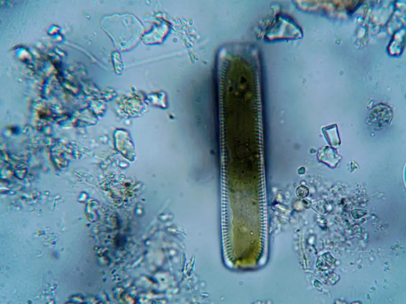 A microorganism under a microscope.